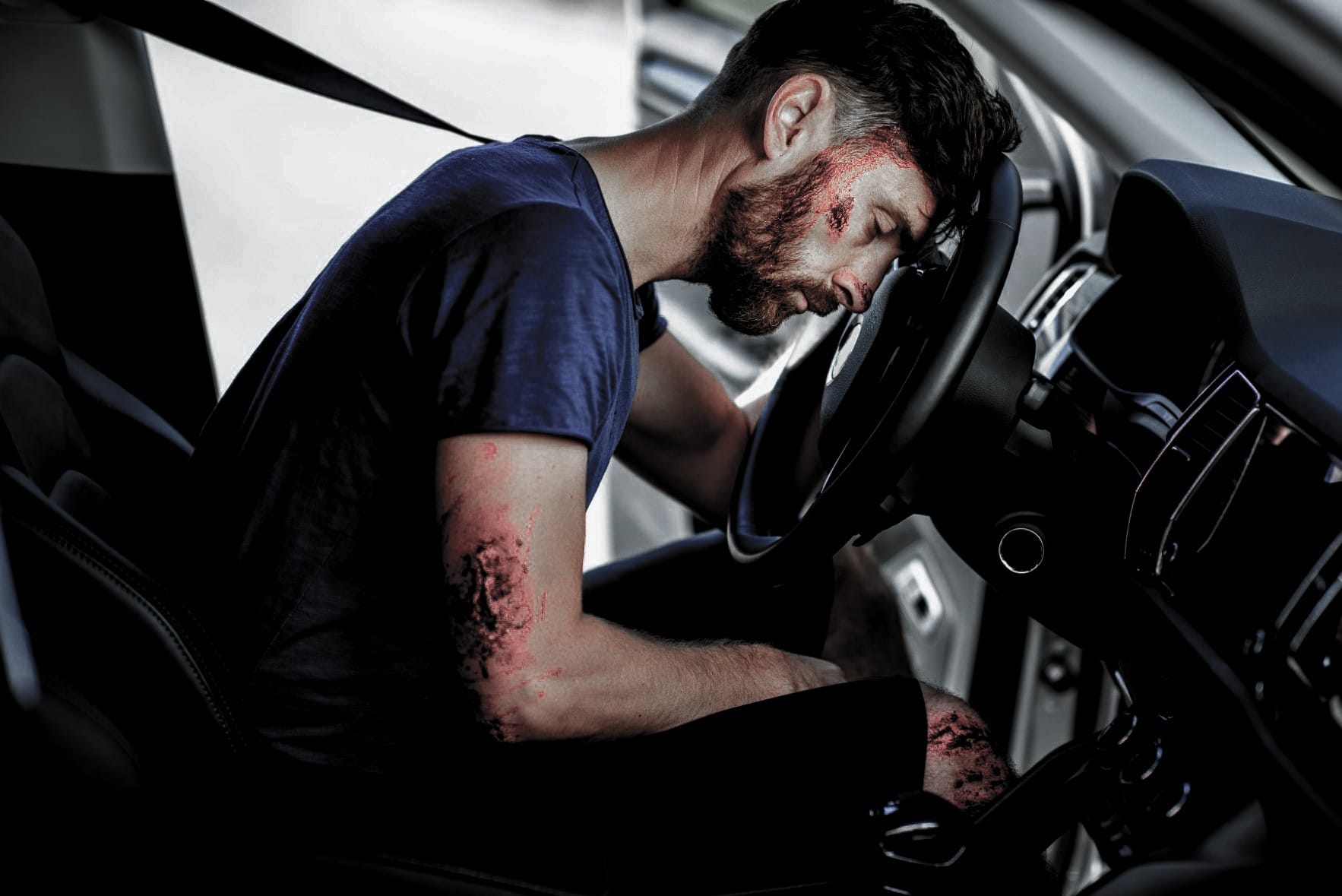 injured-man-streering-wheel