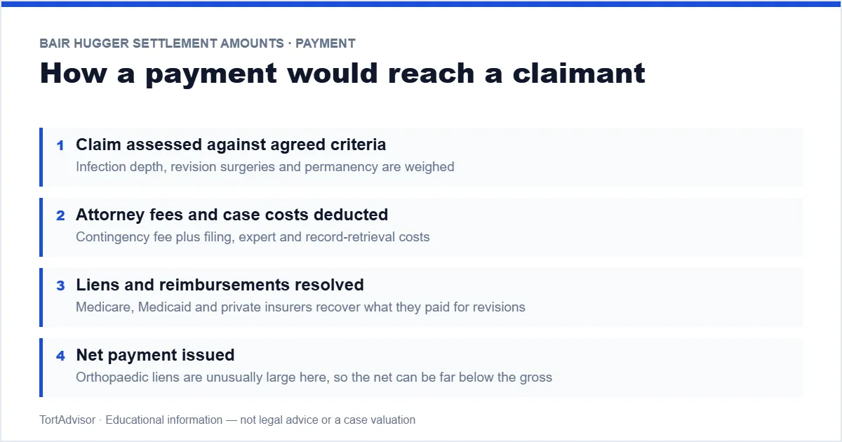 How a Bair Hugger settlement payment would reach a claimant — allocation, fees, liens, net
