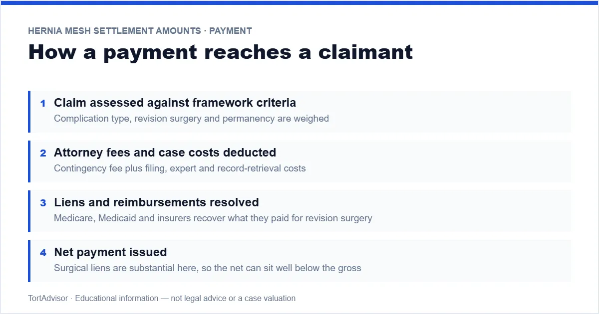 How a hernia mesh settlement payment reaches a claimant — allocation, fees, liens, net